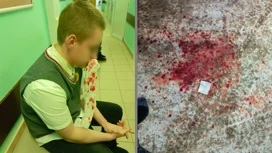 Novosibirsk Teenager wurde brutal geschlagen in der Nähe der Schule wegen der Spekulation anderer Menschen