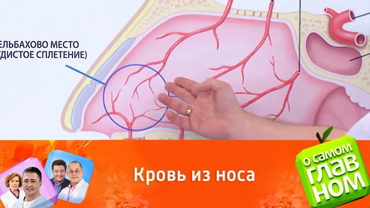 О самом главном Кровотечения из носа: что надо знать