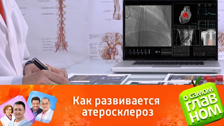 О самом главном Почему надо следить за уровнем холестерина: рекомендации врачей